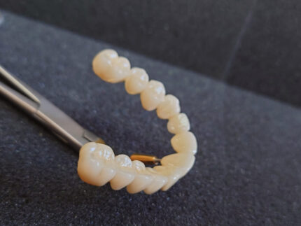 Lucrări protetice mobile