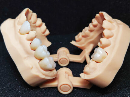 Gutiere (per arcadă)